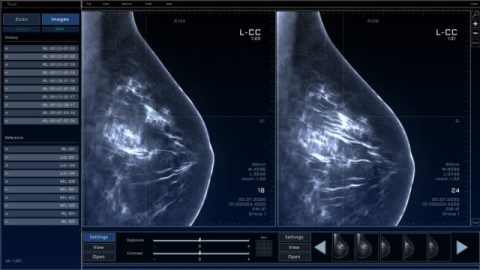 Mammograms | Perumal & Partners